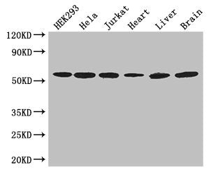 Western Blot | Positive WB detected in: HEK293 whole cell lysate, Hela whole cell lysate, Jurkat whole cell lysate, Mouse heart tissue, Mouse liver tissue, Mouse brain tissue | All lanes: ARIH2 antibody at 3μg/ml | Secondary | Goat polyclonal to rabbit IgG at 1/50000 dilution | Predicted band size: 58 kDa | Observed band size: 58 kDa