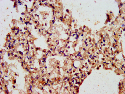 IHC image of ARL1 Antibody diluted at 1:300 and staining in paraffin-embedded human lung tissue performed on a Leica BondTM system. After dewaxing and hydration, antigen retrieval was mediated by high pressure in a citrate buffer (pH 6.0). Section was blocked with 10% normal goat serum 30min at RT. Then primary antibody (1% BSA) was incubated at 4°C overnight. The primary is detected by a biotinylated secondary antibody and visualized using an HRP conjugated SP system.Rabbit anti-Human ARL1 Polyclonal Antibody