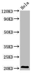 Western Blot  | Positive WB detected in: Hela whole cell lysate  | All lanes: ARL1 antibody at 5.1µg/ml  | Secondary  | Goat polyclonal to rabbit IgG at 1/50000 dilution  | Predicted band size: 21, 19 kDa  | Observed band size: 21 kDa
