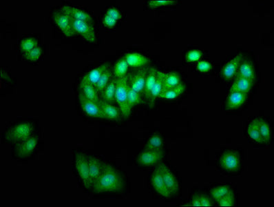 Immunofluorescence staining of HepG2 cells with ARRB1 Antibody at 1:233, counter-stained with DAPI. The cells were fixed in 4% formaldehyde, permeabilized using 0.2% Triton X-100 and blocked in 10% normal Goat Serum. The cells were then incubated with the antibody overnight at 4°C. The secondary antibody was Alexa Fluor 488-congugated AffiniPure Goat Anti-Rabbit IgG(H+L).Rabbit anti-Human ARRB1 Polyclonal Antibody