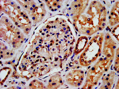 IHC image of ARRB1 Antibody diluted at 1:300 and staining in paraffin-embedded human kidney tissue performed on a Leica BondTM system. After dewaxing and hydration, antigen retrieval was mediated by high pressure in a citrate buffer (pH 6.0). Section was blocked with 10% normal goat serum 30min at RT. Then primary antibody (1% BSA) was incubated at 4°C overnight. The primary is detected by a biotinylated secondary antibody and visualized using an HRP conjugated SP system.Rabbit anti-Human ARRB1 Polyclonal Antibody