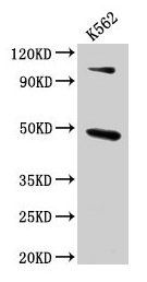 Western Blot  | Positive WB detected in: K562 whole cell lysate  | All lanes: ARRB1 antibody at 4.6µg/ml  | Secondary  | Goat polyclonal to rabbit IgG at 1/50000 dilution  | Predicted band size: 48, 47 kDa  | Observed band size: 48 kDaRabbit anti-Human ARRB1 Polyclonal Antibody