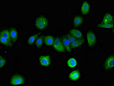 Immunofluorescent analysis of HepG2 cells using ARRB2 Antibody at dilution of 1:100 and Alexa Fluor 488-congugated AffiniPure Goat Anti-Rabbit IgG(H+L)Rabbit anti-Human ARRB2 Polyclonal Antibody