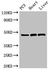 Western Blot  | Positive WB detected in: PC-3 whole cell lysate, Rat heart tissue, Rat liver tissue  | All lanes: ARRB2 antibody at 3.5µg/ml  | Secondary  | Goat polyclonal to rabbit IgG at 1/50000 dilution  | Predicted band size: 47, 48, 46, 49, 45 kDa  | Observed band size: 47 kDa