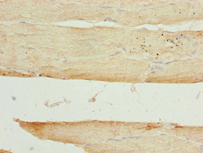 Immunohistochemistry of paraffin-embedded human skeletal muscle tissue using ARSG Antibody at dilution of 1:100Rabbit anti-Human ARSG Polyclonal Antibody