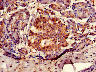Immunohistochemistry of paraffin-embedded human pancreatic tissue using ARSG Antibody at dilution of 1:100Rabbit anti-Human ARSG Polyclonal Antibody