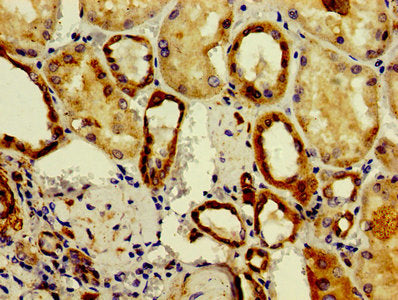 Immunohistochemistry of paraffin-embedded human kidney tissue using ASAH2 Antibody at dilution of 1:100Rabbit anti-Human ASAH2 Polyclonal Antibody