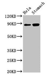 Western Blot  | Positive WB detected in: Hela whole cell lysate, Rat stomach tissue  | All lanes: ASAH2 antibody at 3µg/ml  | Secondary  | Goat polyclonal to rabbit IgG at 1/50000 dilution  | Predicted band size: 86, 82 kDa  | Observed band size: 86 kDaRabbit anti-Human ASAH2 Polyclonal Antibody