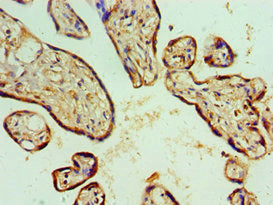 Immunohistochemistry of paraffin-embedded human placenta tissue using ASCC3 Antibody at dilution of 1:100Rabbit anti-Human ASCC3 Polyclonal Antibody