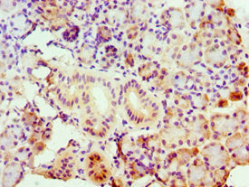 Immunohistochemistry of paraffin-embedded human pancreatic tissue using ASCC3 Antibody at dilution of 1:100Rabbit anti-Human ASCC3 Polyclonal Antibody