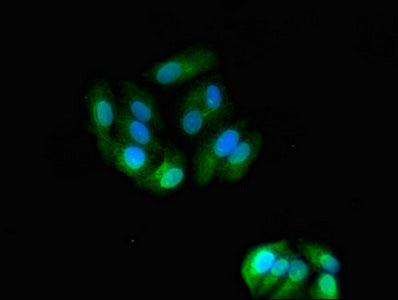Immunofluorescent analysis of HepG2 cells using ASGR2 Antibody at dilution of 1:100 and Alexa Fluor 488-congugated AffiniPure Goat Anti-Rabbit IgG(H+L)Rabbit anti-Human ASGR2 Polyclonal Antibody