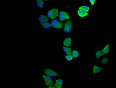 Immunofluorescence staining of Hela cells with ASL Antibody at 1:100, counter-stained with DAPI. The cells were fixed in 4% formaldehyde, permeabilized using 0.2% Triton X-100 and blocked in 10% normal Goat Serum. The cells were then incubated with the antibody overnight at 4°C. The secondary antibody was Alexa Fluor 488-congugated AffiniPure Goat Anti-Rabbit IgG(H+L).Rabbit anti-Human ASL Polyclonal Antibody