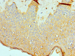 Immunohistochemistry of paraffin-embedded human skin tissue using ASMTL Antibody at dilution of 1:100Rabbit anti-Human ASMTL Polyclonal Antibody