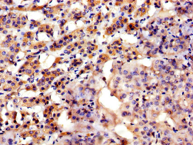 IHC image of ASPH Antibody diluted at 1:300 and staining in paraffin-embedded human adrenal gland tissue performed on a Leica BondTM system. After dewaxing and hydration, antigen retrieval was mediated by high pressure in a citrate buffer (pH 6.0). Section was blocked with 10% normal goat serum 30min at RT. Then primary antibody (1% BSA) was incubated at 4°C overnight. The primary is detected by a biotinylated secondary antibody and visualized using an HRP conjugated SP system.Rabbit anti-Human ASPH Polyclonal Antibody
