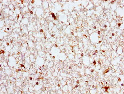 IHC image of ASPH Antibody diluted at 1:300 and staining in paraffin-embedded human brain tissue performed on a Leica BondTM system. After dewaxing and hydration, antigen retrieval was mediated by high pressure in a citrate buffer (pH 6.0). Section was blocked with 10% normal goat serum 30min at RT. Then primary antibody (1% BSA) was incubated at 4°C overnight. The primary is detected by a biotinylated secondary antibody and visualized using an HRP conjugated SP system.Rabbit anti-Human ASPH Polyclonal Antibody