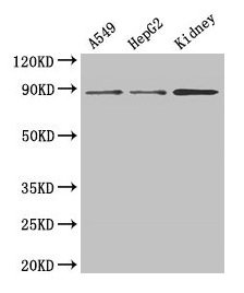 Western Blot  | Positive WB detected in: A549 whole cell lysate, HepG2 whole cell lysate, Mouse kidney tissue  | All lanes: ASPH antibody at 3µg/ml  | Secondary  | Goat polyclonal to rabbit IgG at 1/50000 dilution  | Predicted band size: 86, 35, 26, 24, 34, 84, 30, 22, 29, 33 kDa  | Observed band size: 86 kDaRabbit anti-Human ASPH Polyclonal Antibody