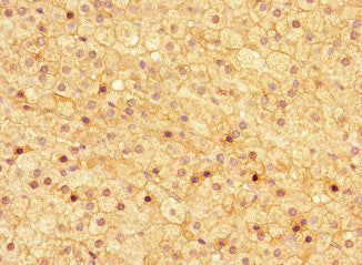 Immunohistochemistry of paraffin-embedded human adrenal gland tissue using ASPN Antibody at dilution of 1:100Rabbit anti-Human ASPN Polyclonal Antibody