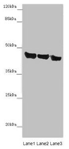 Western blot | All lanes: ASPN antibody at 14 μg/ml | Lane 1: Mouse heart tissue | Lane 2: Mouse liver tissue | Lane 3: HL60 whole cell lysate | Secondary | Goat polyclonal to rabbit IgG at 1/10000 dilution | Predicted band size: 43 kDa | Observed band size: 43 kDa