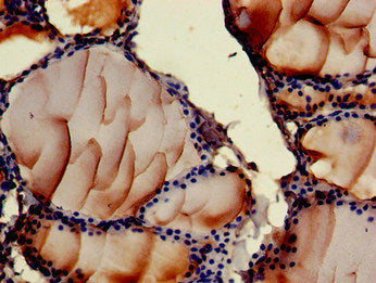 Immunohistochemistry of paraffin-embedded human thyroid tissue using ASTN2 Antibody at dilution of 1:100