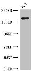 Western Blot  | Positive WB detected in: PC-3 whole cell lysate  | All lanes: ASTN2 antibody at 3.4µg/ml  | Secondary  | Goat polyclonal to rabbit IgG at 1/50000 dilution  | Predicted band size: 149, 143, 148, 50, 45 kDa  | Observed band size: 149 kDa