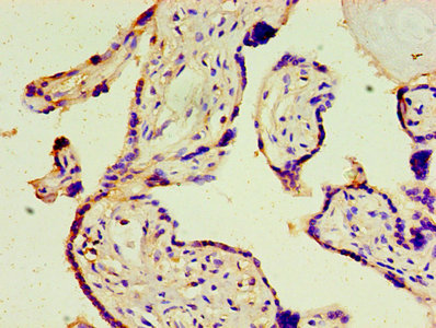 Immunohistochemistry of paraffin-embedded human placenta tissue using the antibody at dilution of 1:100Rabbit anti-Human ATF3 Polyclonal Antibody