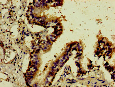Immunohistochemistry of paraffin-embedded human lung tissue using ATF3 Antibody at dilution of 1:100Rabbit anti-Human ATF3 Polyclonal Antibody
