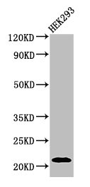Western Blot  | Positive WB detected in: HEK293 whole cell lysate  | All lanes: ATF3 antibody at 3µg/ml  | Secondary  | Goat polyclonal to rabbit IgG at 1/50000 dilution  | Predicted band size: 21, 14, 16, 13, 15 kDa  | Observed band size: 21 kDaRabbit anti-Human ATF3 Polyclonal Antibody