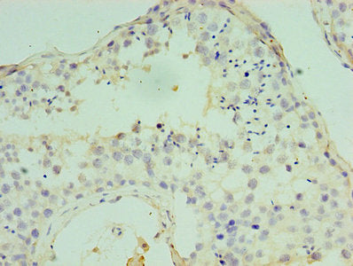 Immunohistochemistry of paraffin-embedded human testis tissue using ATF7 Antibody at dilution of 1:100Rabbit anti-Human ATF7 Polyclonal Antibody