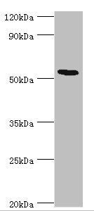 Western blot | All lanes: ATF7 antibody at 12μg/ml + Hela whole cell lysate | Secondary | Goat polyclonal to rabbit IgG at 1/10000 dilution | Predicted band size: 53, 50, 51, 34, 14, 52 kDa | Observed band size: 53 kDa