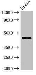 Western Blot | Positive WB detected in: Mouse brain tissue | All lanes: ATG4B antibody at 3.4μg/ml | Secondary | Goat polyclonal to rabbit IgG at 1/50000 dilution | Predicted band size: 45, 53, 32, 38, 43 kDa | Observed band size: 45 kDa