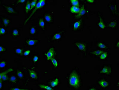 Immunofluorescent analysis of U251 cells using ATG7 Antibody at dilution of 1:100 and Alexa Fluor 488-congugated AffiniPure Goat Anti-Rabbit IgG(H+L)