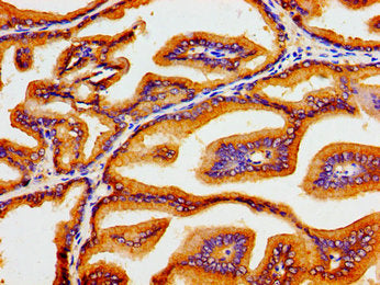 Immunohistochemistry of paraffin-embedded human prostate tissue using ATP1B1 Antibody at dilution of 1:100