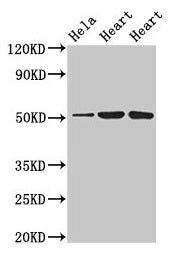 Western Blot  | Positive WB detected in: Hela whole cell lysate, Rat heart tissue, Mouse heart tissue  | All lanes: ATP1B1 antibody at 3µg/ml  | Secondary  | Goat polyclonal to rabbit IgG at 1/50000 dilution  | Predicted band size: 36, 35 kDa  | Observed band size: 52 kDa