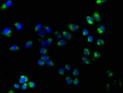 Immunofluorescence staining of Hela cells with ATP1B3 Antibody at 1:160, counter-stained with DAPI. The cells were fixed in 4% formaldehyde, permeabilized using 0.2% Triton X-100 and blocked in 10% normal Goat Serum. The cells were then incubated with the antibody overnight at 4°C. The secondary antibody was Alexa Fluor 488-congugated AffiniPure Goat Anti-Rabbit IgG(H+L).