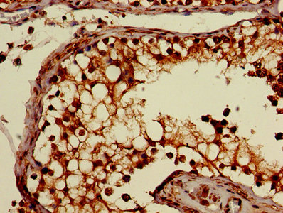 Immunohistochemistry of paraffin-embedded human testis tissue using ATP1B3 Antibody at dilution of 1:100