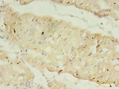 Immunohistochemistry of paraffin-embedded human heart tissue using ATP2A2 Antibody at dilution of 1:100
