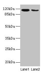 Western blot  | All lanes: ATP2A2 antibody at 6µg/ml  | Lane 1: Mouse heart tissue  | Lane 2: Mouse skeletal muscle tissue  | Secondary  | Goat polyclonal to rabbit IgG at 1/10000 dilution  | Predicted band size: 115, 110, 112 kDa  | Observed band size: 115 kDa