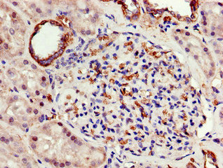 Immunohistochemistry of paraffin-embedded human kidney tissue using ATP5F1A Antibody at dilution of 1:100