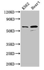 Western Blot | Positive WB detected in: K562 whole cell lysate, Mouse heart tissue | All lanes: ATP5F1A antibody at 2.5μg/ml | Secondary | Goat polyclonal to rabbit IgG at 1/50000 dilution | Predicted band size: 60, 55, 58 kDa | Observed band size: 60 kDa