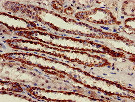 Immunohistochemistry of paraffin-embedded human kidney tissue using ATP5B Antibody at dilution of 1:100