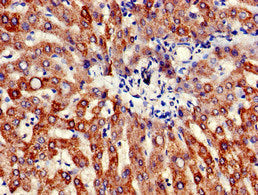 Immunohistochemistry of paraffin-embedded human liver tissue using ATP5B Antibody at dilution of 1:100