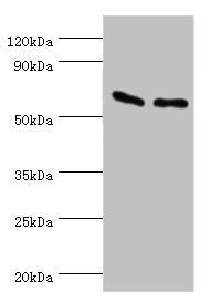 Western blot | All lanes: ATP synthase subunit beta, mitochondrial antibody at 9μg/ml | Lane 1: Hela whole cell lysate | Lane 2: HepG2 whole cell lysate | Secondary | Goat polyclonal to rabbit IgG at 1/10000 dilution | Predicted band size: 57 kDa | Observed band size: 57 kDa
