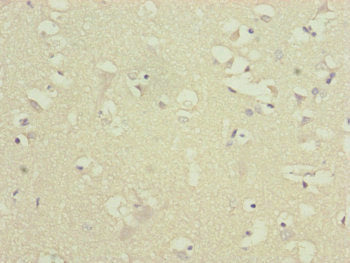 Immunohistochemistry of paraffin-embedded human brain tissue using ATP5F1D Antibody at dilution of 1:100Rabbit anti-Human ATP5D Polyclonal Antibody