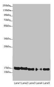 Western blot  | All lanes: ATP5F1D antibody at 1.94µg/ml  | Lane 1: Raji whole cell lysate  | Lane 2: NIH/3T3 whole cell lysate  | Lane 3: A549 whole cell lysate  | Lane 4: MDA-MB-231 whole cell lysate  | Lane 5: HepG2 whole cell lysate  | Secondary  | Goat polyclonal to rabbit IgG at 1/10000 dilution  | Predicted band size: 18 kDa  | Observed band size: 18 kDa