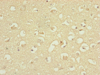 Immunohistochemistry of paraffin-embedded human brain tissue using ATP5H Antibody at dilution of 1:100