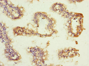 Immunohistochemistry of paraffin-embedded human small intestine tissue using ATP5H Antibody at dilution of 1:100