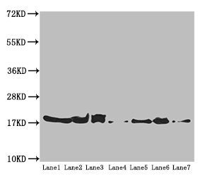 Western blot | All lanes: ATP5H antibody at 5.16 μg/ml | Lane 1: Mouse kidney tissue | Lane 2: Mouse liver tissue | Lane 3: Mouse brain tissue | Lane 4: Hela whole cell lysate | Lane 5: HepG2 whole cell lysate | Lane 6: PC-3 whole cell lysate | Lane 7: U251 whole cell lysate | Secondary | Goat polyclonal to rabbit IgG at 1/10000 dilution | Predicted band size: 19, 16 kDa | Observed band size: 19 kDa