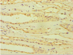 Immunohistochemistry of paraffin-embedded human kidney tissue using ATP5J Antibody at dilution of 1:100