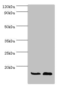 Western blot | All lanes: ATP5J antibody at 7μg/ml | Lane 1: Rat brain tissue | Lane 2: Mouse heart tissue | Secondary | Goat polyclonal to rabbit IgG at 1/10000 dilution | Predicted band size: 13, 14 kDa | Observed band size: 13 kDa