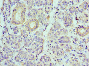 Immunohistochemistry of paraffin-embedded human salivary gland tissue using ATP6V1B1 Antibody at dilution of 1:100
